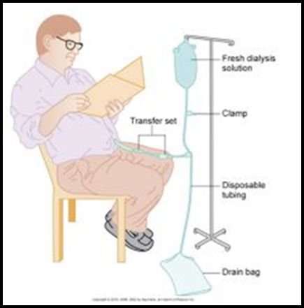 What is Peritoneal Dialysis