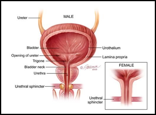 types of Bladder Cancer